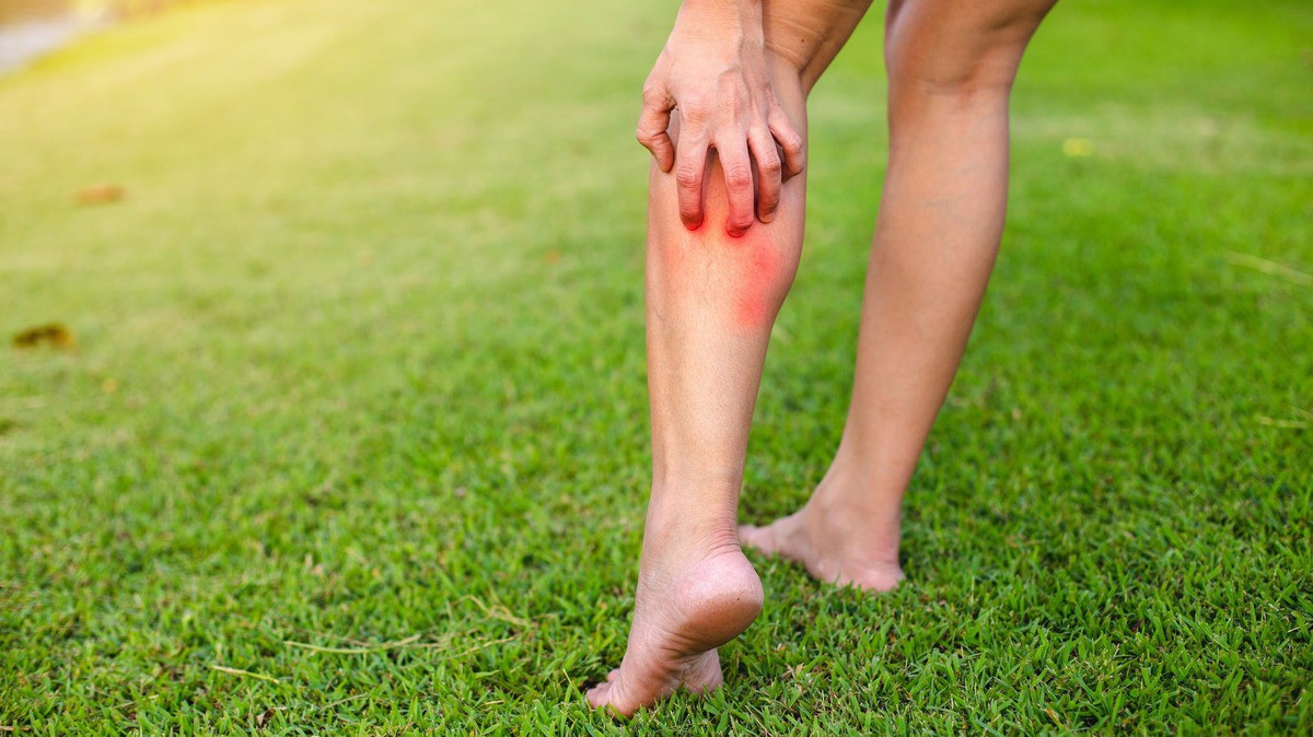 Bị côn trùng chích mấy tuần không lành, ông bố 3 con đi khám phát hiện ...