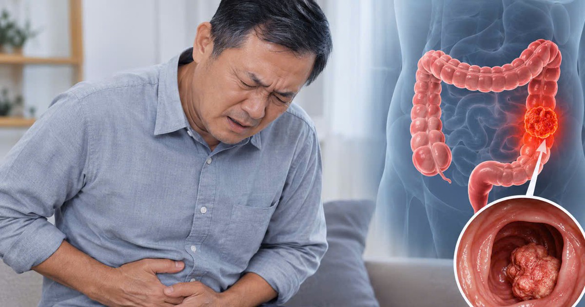 Bác sĩ chỉ: 6 DẤU HIỆU cảnh báo ung thư ruột, nhiều người nhầm tưởng là "rối loạn tiêu hóa"