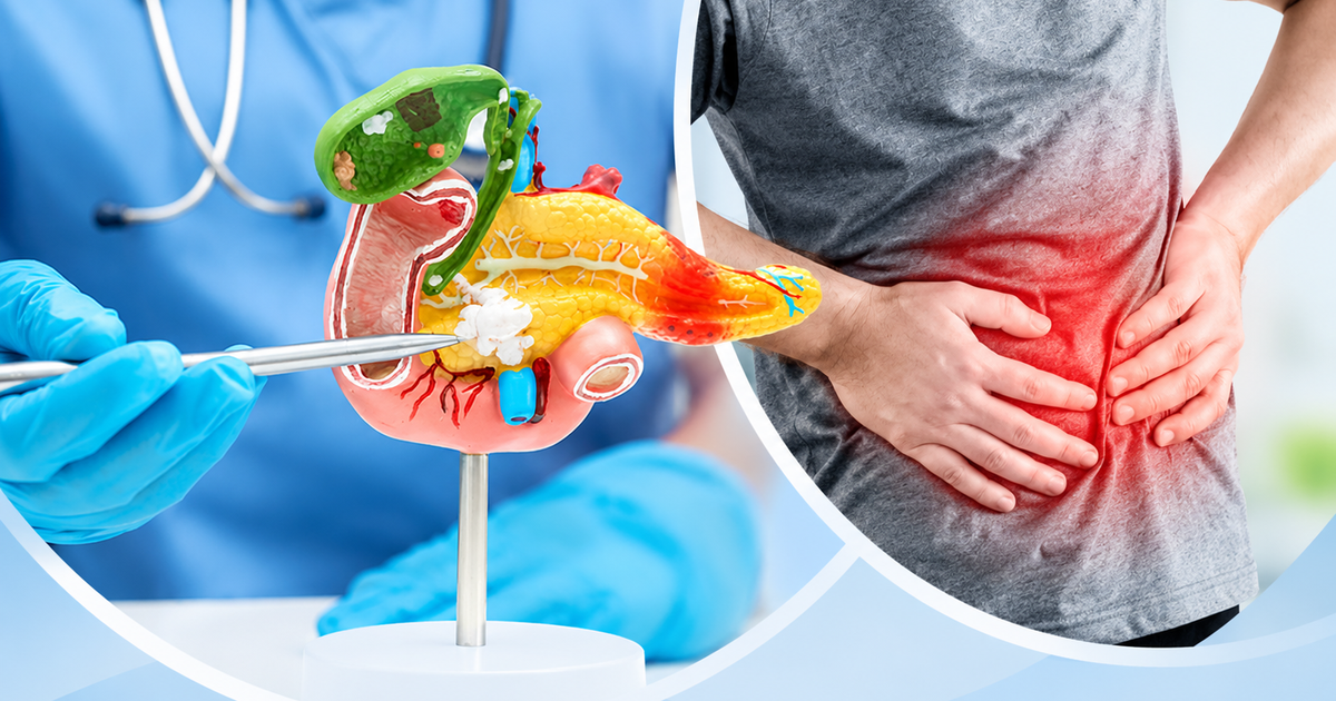 Khám cho nhiều người mắc ung thư tuyến tụy giai đoạn cuối, bác sĩ tiếc nuối: Dấu hiệu xuất hiện sớm nhưng hay bị bỏ qua