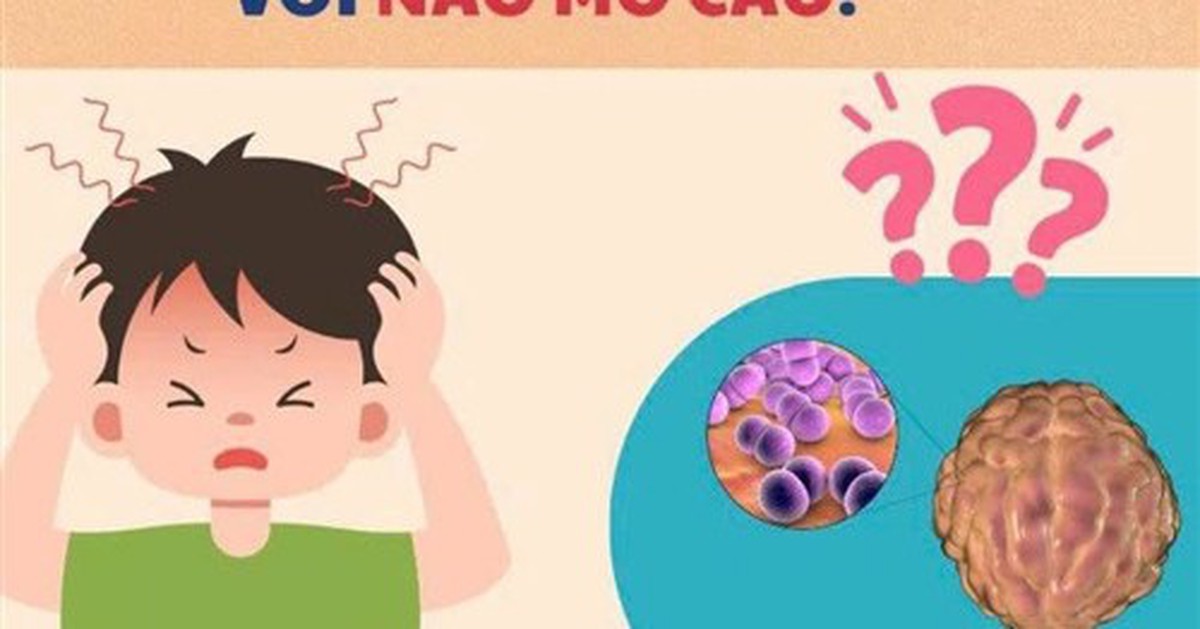 Cúm mùa và não mô cầu đều có thể gây sốt cao đột ngột: Bác sĩ Trương Hữu Khanh chỉ cách phân biệt 2 bệnh