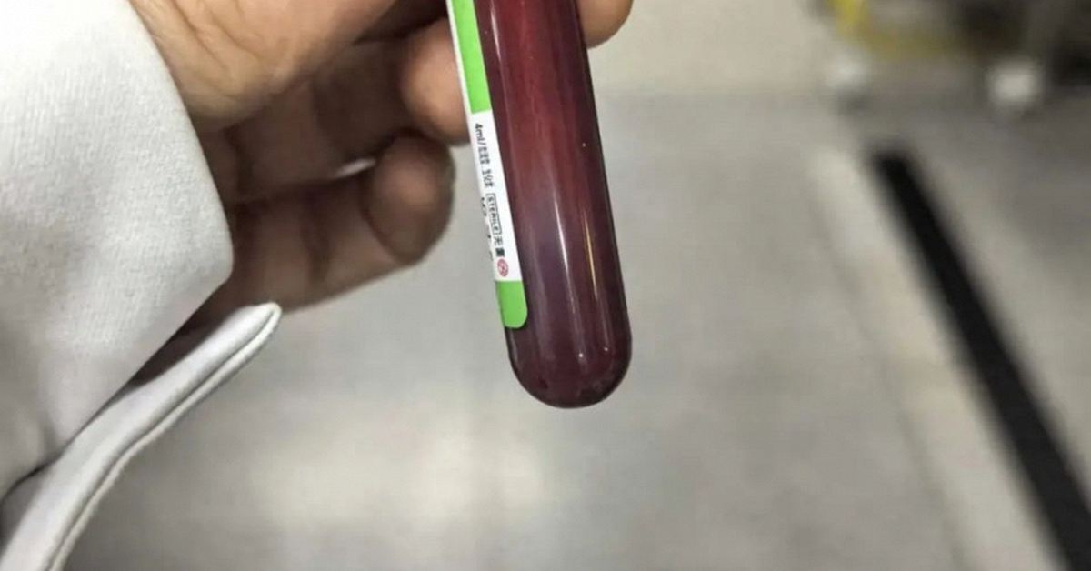 Mẹ bầu nghiện ăn gà rán, hamburger, tăng 5kg chỉ sau 1 tuần, cả mẹ lẫn con phải đi cấp cứu