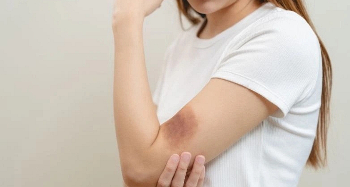 Muốn biết gan khỏe hay yếu, chỉ cần nhìn vào làn da sẽ rõ: Có 5 dấu hiệu này phải đi khám ngay