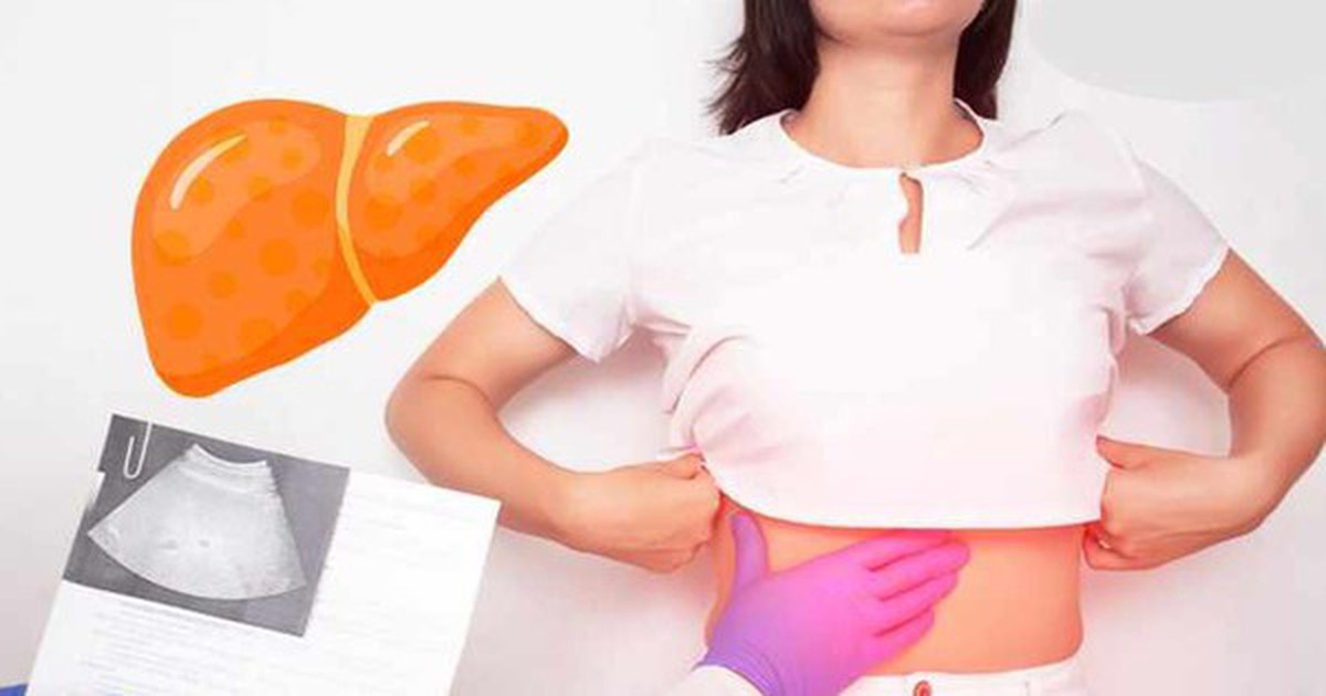 Với gan nhiễm mỡ, ngoài “ngậm miệng và đá chân", còn có 1 việc bắt buộc phải làm mà nhiều người không biết