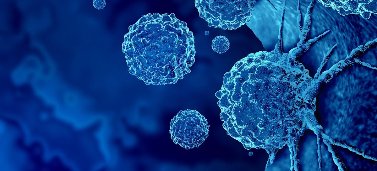 Loại ung thư đứng thứ 2 về tỉ lệ tử vong tại Việt Nam: 5 dấu hiệu sớm nhất ai cũng nên biết