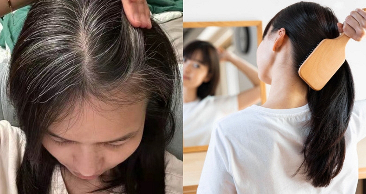 Nhiều người chưa 30 tuổi đã bạc tóc: 3 nhóm người dễ có tóc bạc nhất và 3 cách đơn giản giúp tóc đen lâu hơn