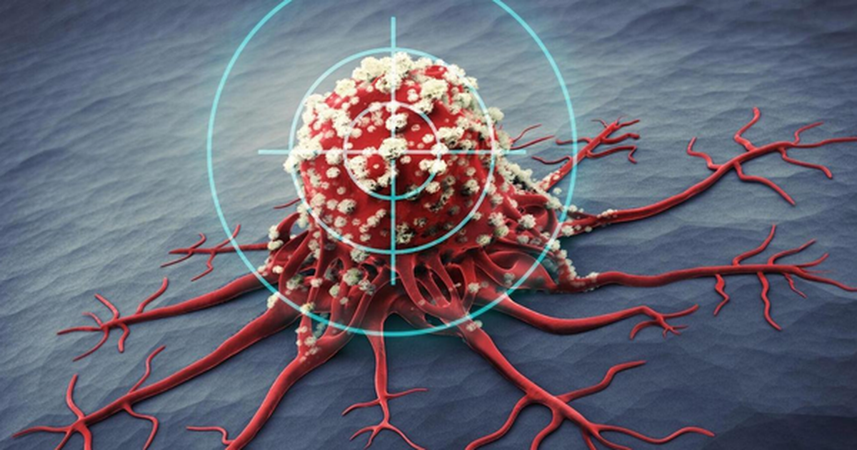 Một năm trước khi ung thư phát triển, cơ thể sẽ phát ra 5 dấu hiệu cảnh báo, nhưng 90% người lại bỏ qua