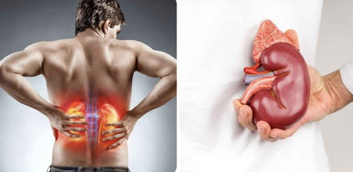 Nghiên cứu trên 417 người chỉ ra 5 ĐIỂM chung của người suy thận: Nhiều thói quen người Việt vẫn vô tình làm mỗi ngày