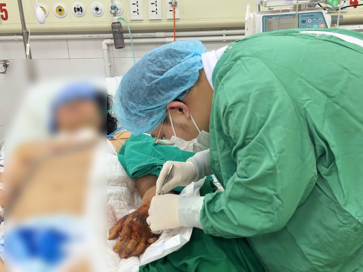 Vi khuẩn "ăn mòn" bàn tay sau mũi tiêm, người phụ nữ suýt mất mạng