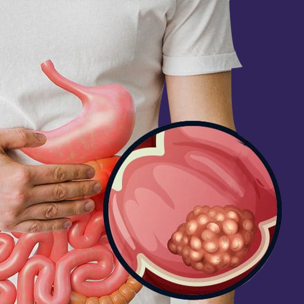 Phát hiện ung thư giai đoạn 4 ở tuổi 26, nam thanh niên hối hận: Giá như tôi không bỏ qua triệu chứng này