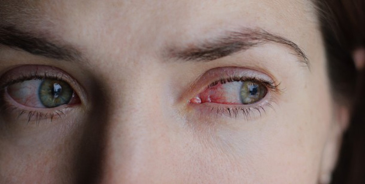 Chàng trai 24 tuổi mù đột ngột: Bác sĩ cảnh báo về thói quen mà nhiều người trẻ đang mắc mỗi tuần