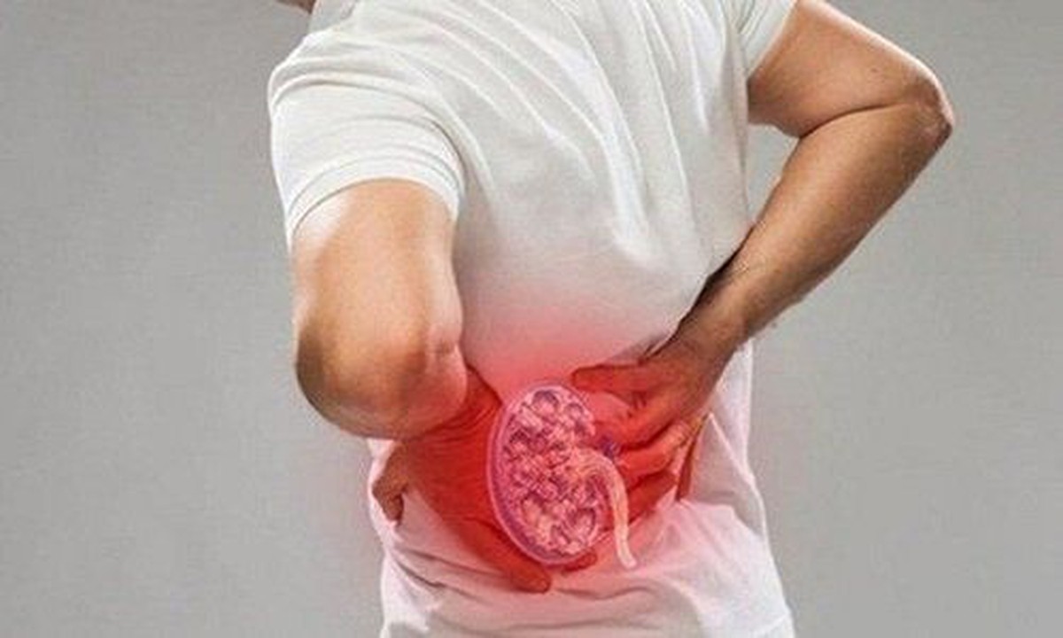 Phân tích hàng nghìn bệnh nhân suy thận: 4 ĐIỂM chung âm thầm nhưng rất nhiều người Việt đang mắc mỗi ngày