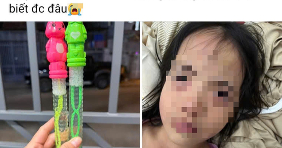 Bé gái 5 tuổi tổn thương mắt sau khi thổi bong bóng xà phòng