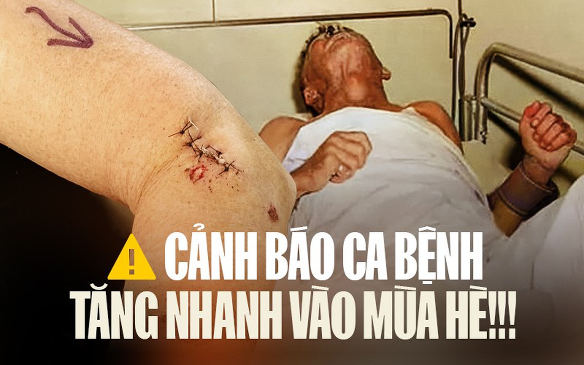 1 căn bệnh đang tăng mạnh, đã có 13 ca không qua khỏi chỉ trong 3 tháng đầu năm: Bác sĩ Bệnh viện Bạch Mai cảnh báo khẩn