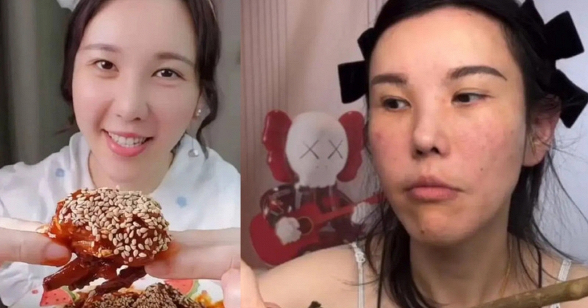 Mặt cô gái trẻ biến dạng sau 2 năm làm mukbang, bác sĩ cảnh báo 4 cái giá phải trả về sức khỏe ít ai biết đến