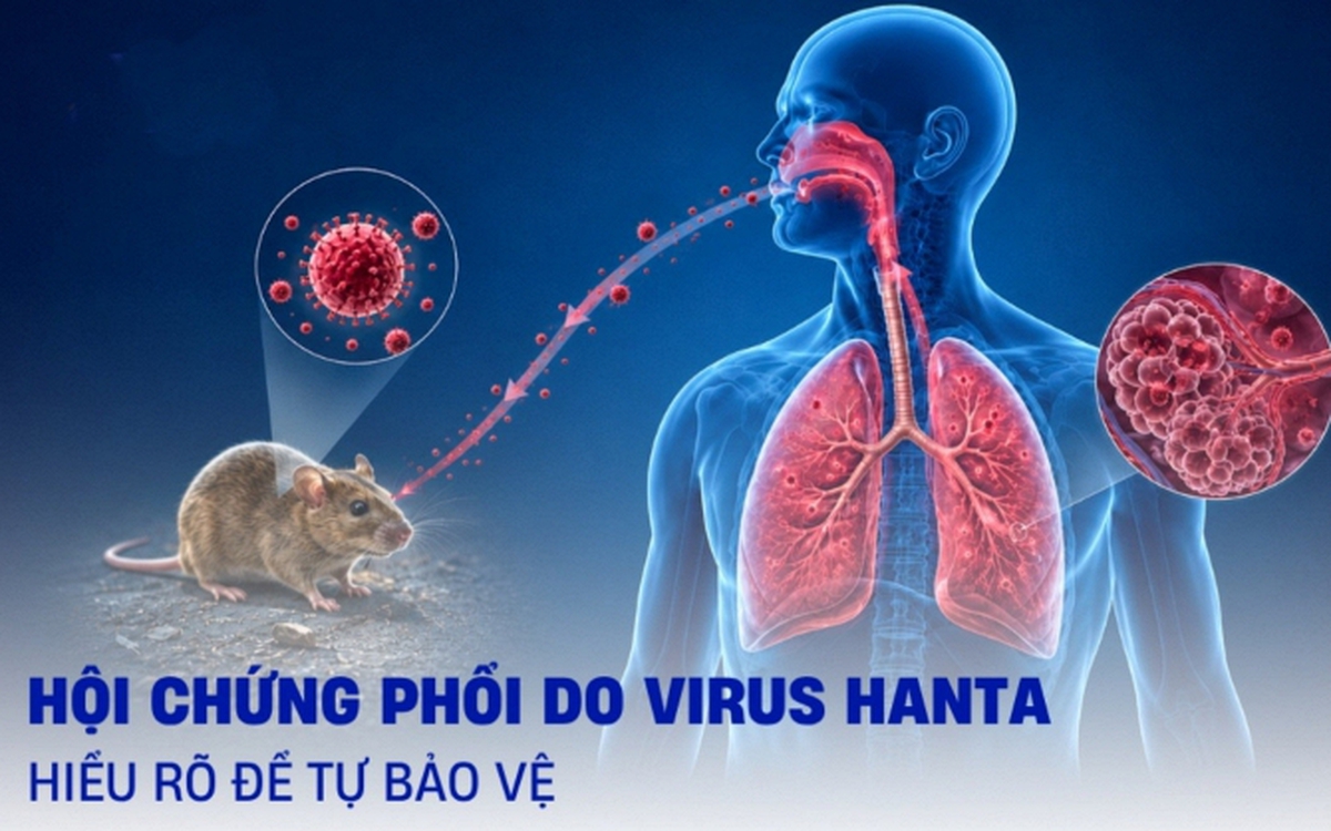 Virus Hanta gây tử vong tới 50%, chuyển biến bệnh cực nhanh: Bệnh viện Bạch Mai cùng các bác sĩ đầu ngành đồng loạt ra cảnh báo