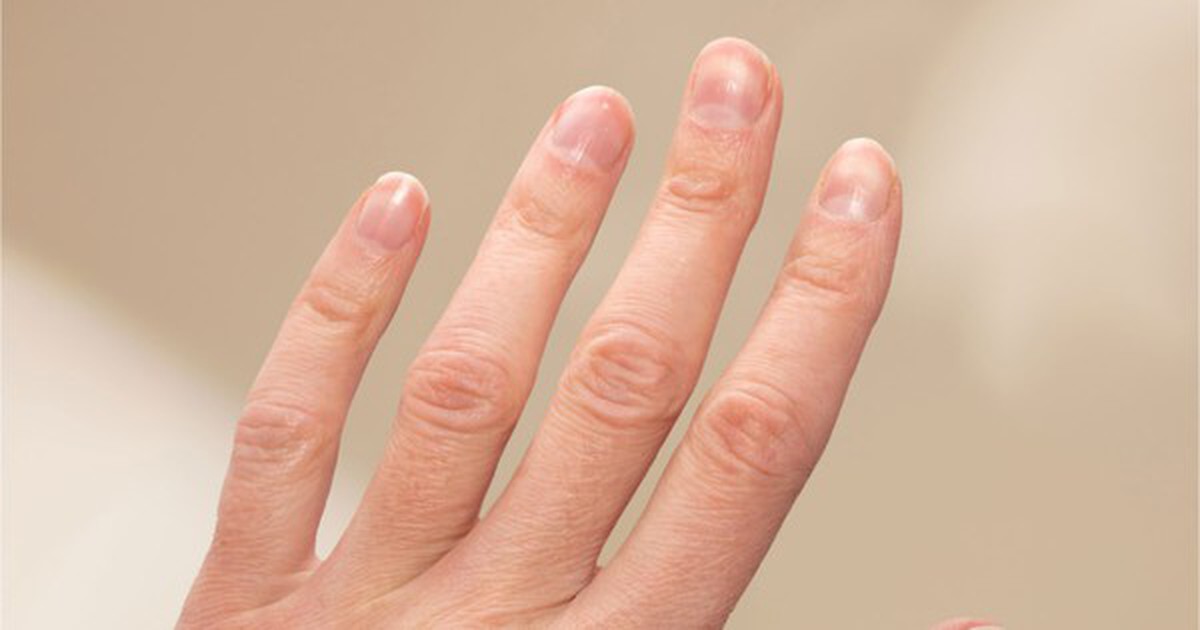 Kiểm tra móng tay ngay xem có dấu hiệu này không - nếu có phải đi khám!