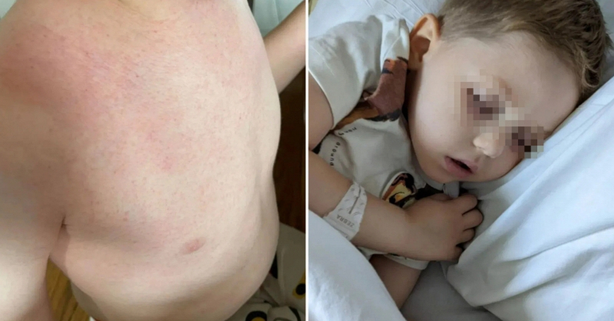 Nam shipper 38 tuổi bật khóc: "Bác sĩ nói vết ngứa trên da con tôi không đáng lo, 3 tuần sau lại bảo là ung thư"