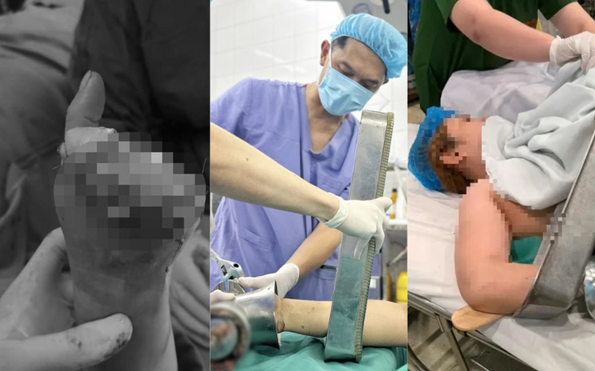 Cảnh báo bất cứ ai đang dùng máy xay thịt