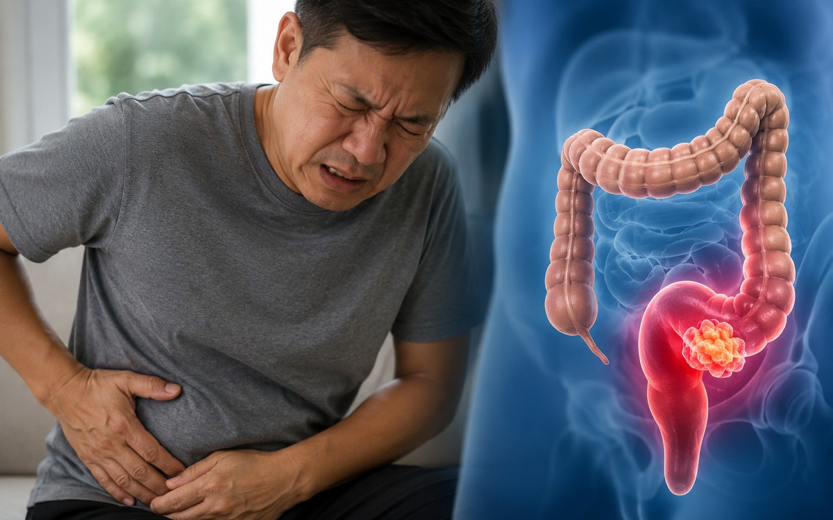 Bác sĩ cảnh báo: 4 DẤU HIỆU sớm của ung thư trực tràng, nhiều người nhầm với đau, chướng bụng bình thường