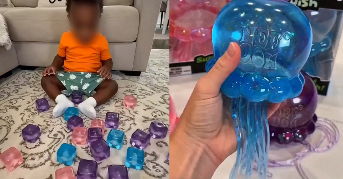 Cảnh báo về món đồ chơi hot Tiktok hàng triệu người đang mua: Con chỉ làm theo một video trên mạng, hậu quả là bỏng mặt và cánh tay