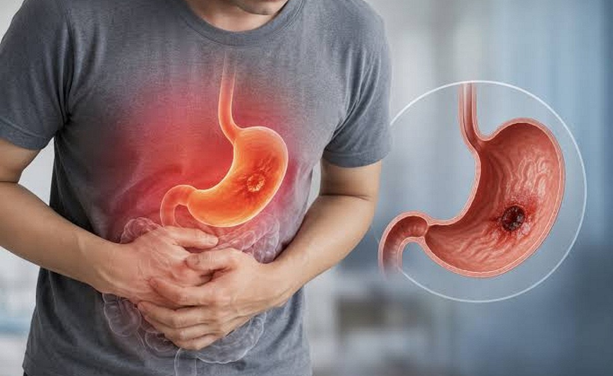 Bác sĩ cảnh báo: 4 DẤU HIỆU khi ăn là biểu hiện của ung thư dạ dày, nhiều người Việt chỉ nghĩ là trạng thái cơ thể bình thường