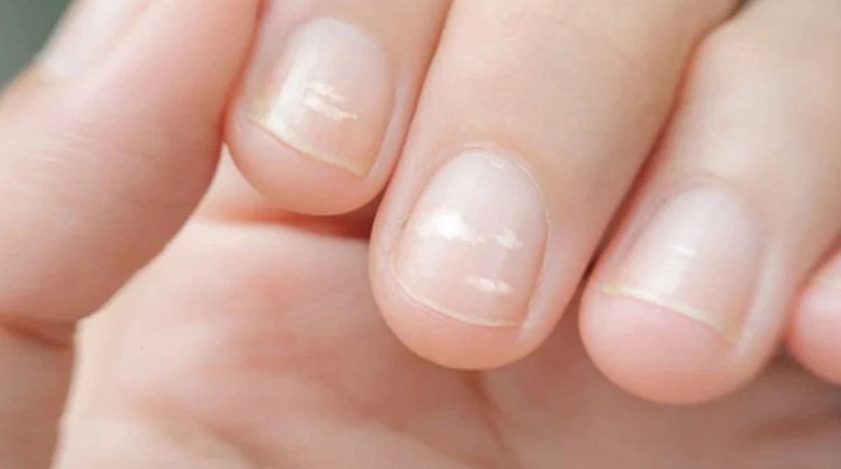 Ung thư có thể được phát hiện qua bàn tay? Bác sĩ cảnh báo: Xuất hiệu 5 dấu hiệu này, đừng nên chủ quan