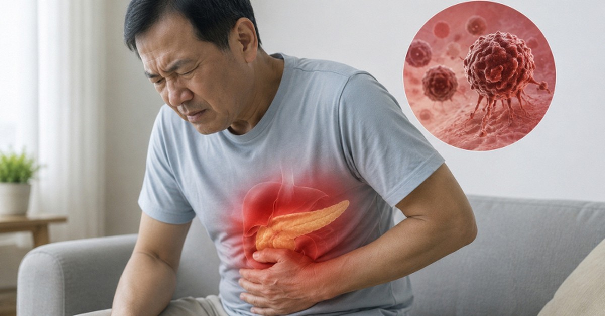 Ung thư tuyến tụy thường "ngụy trang" thành bệnh dạ dày: 6 thay đổi của cơ thể nhiều người dễ bỏ qua