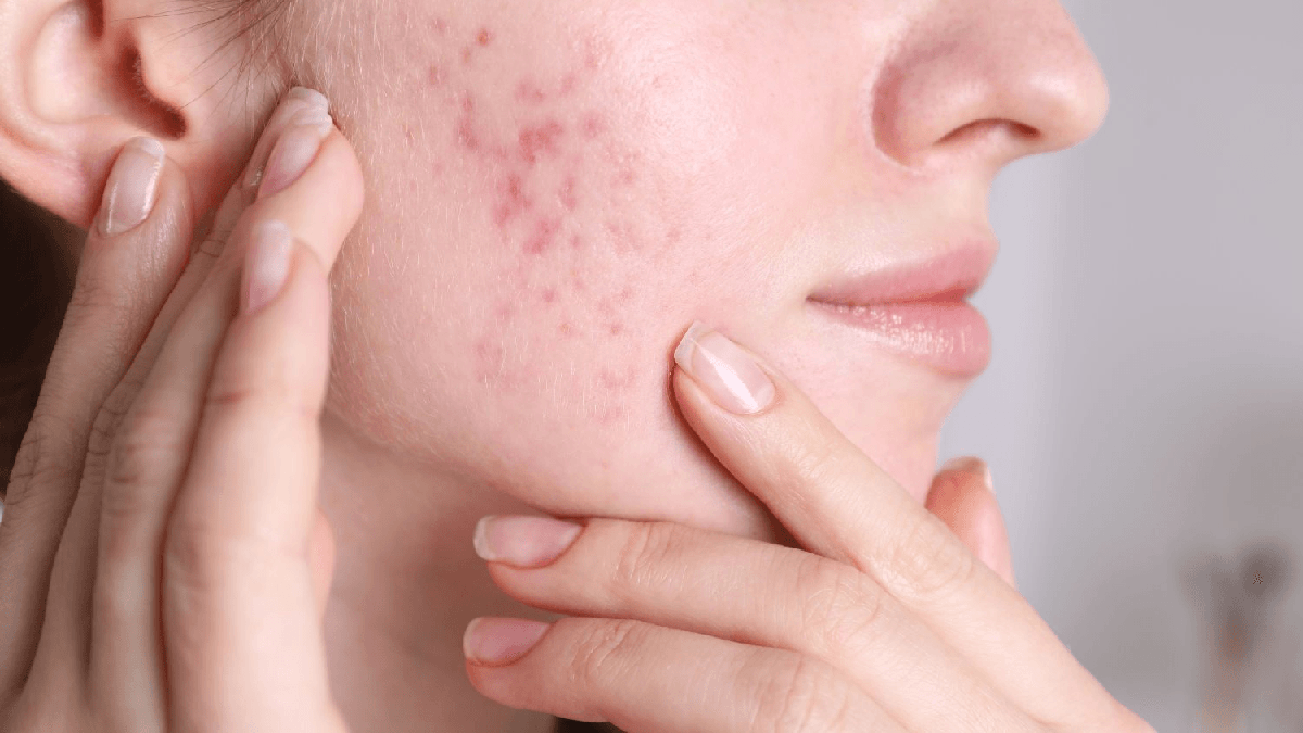Từ mỹ phẩm đến biotech: Vì sao kẽm trở thành tâm điểm trong cuộc đua chăm sóc da dựa trên khoa học?