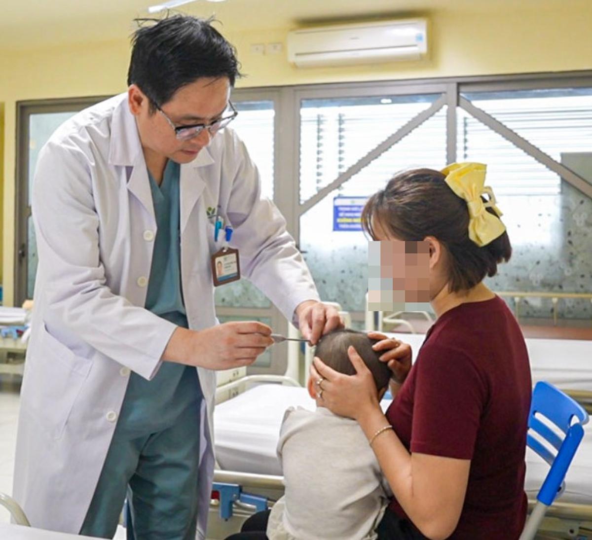 Bệnh viện Nhi Trung ương: Mỗi ngày kéo giãn 1 milimet, từng bước thay đổi khuôn mặt trẻ mắc dị tật sọ mặt