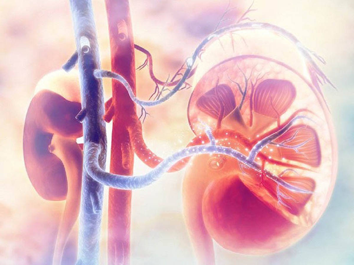 Thói quen của nhiều người Việt khiến thận ứ nước, mỏng như giấy: Bác sĩ cũng phải bất lực