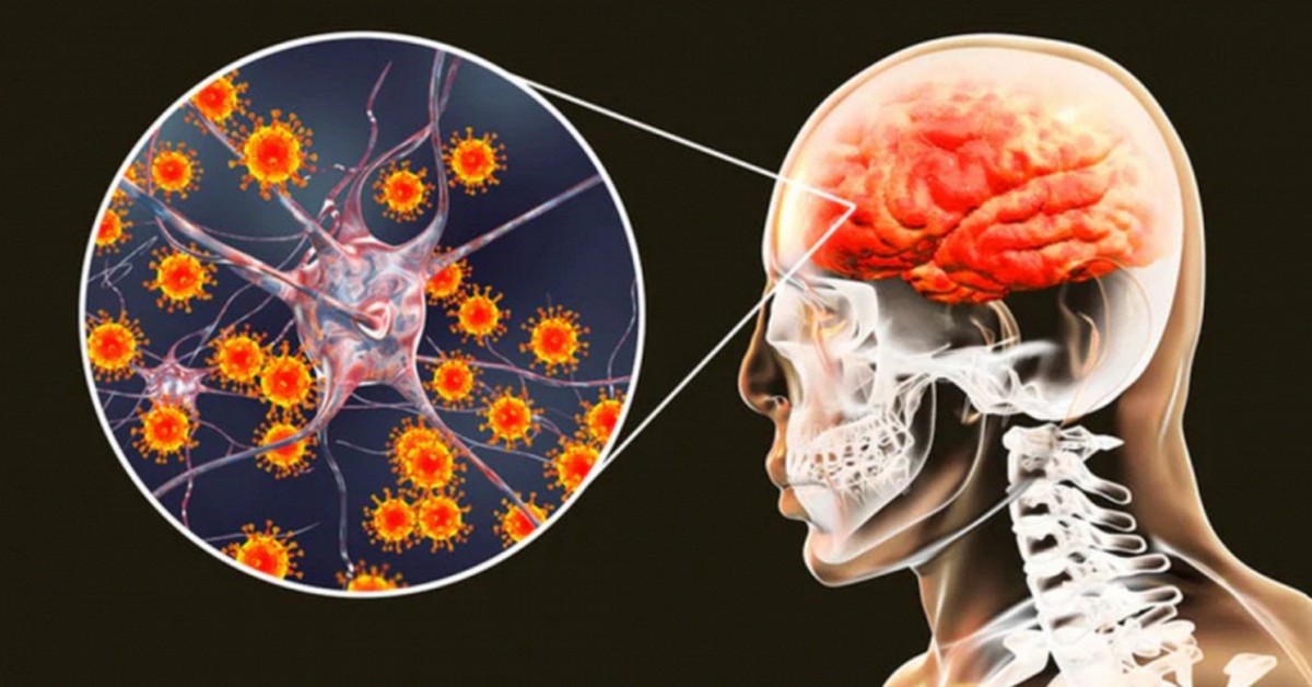 BV Bệnh Nhiệt đới Trung ương cấp cứu bé trai nhiễm virus nguy hiểm, rơi vào hôn mê chỉ sau 2 ngày