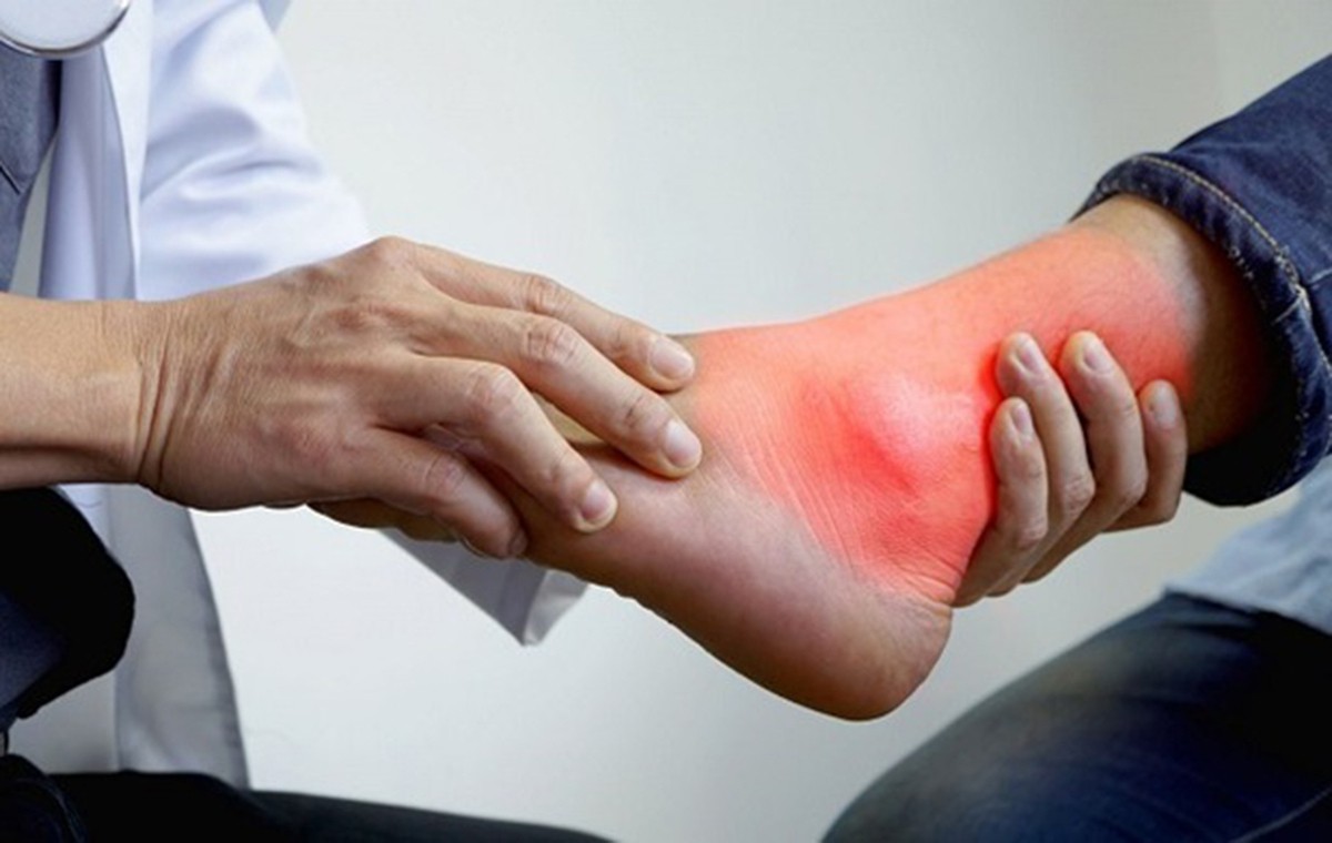 Chủ quan với đau khớp chân, thanh niên 20 tuổi ngỡ ngàng khi phát hiện mắc gout