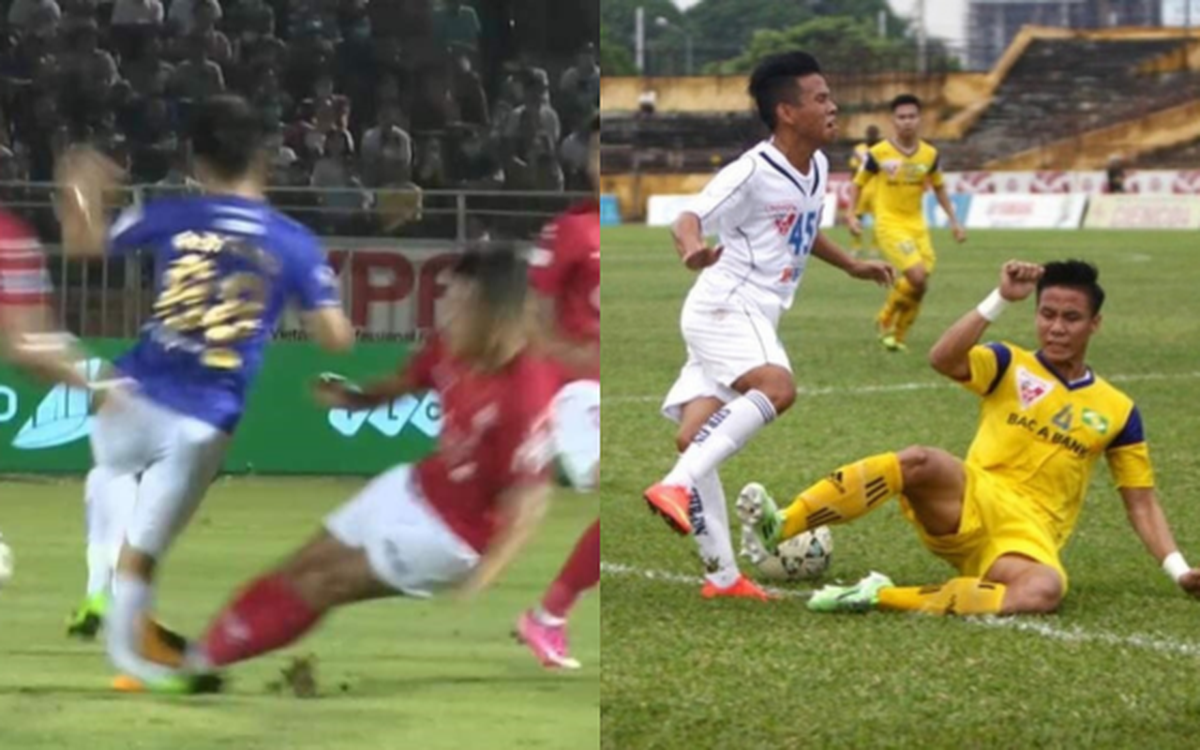 Trước Đoàn Văn Hậu, những pha vào bóng từng khiến bóng đá Việt Nam ám ảnh: Người phải giải nghệ, người mang 7 chiếc đinh trong chân