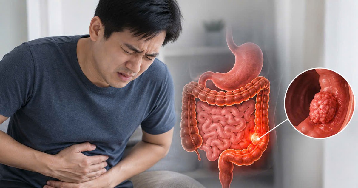 Bác sĩ bệnh viện Bạch Mai cảnh báo 4 DẤU HIỆU ung thư đường tiêu hóa: Nhiều người gặp nhưng chủ quan bỏ qua