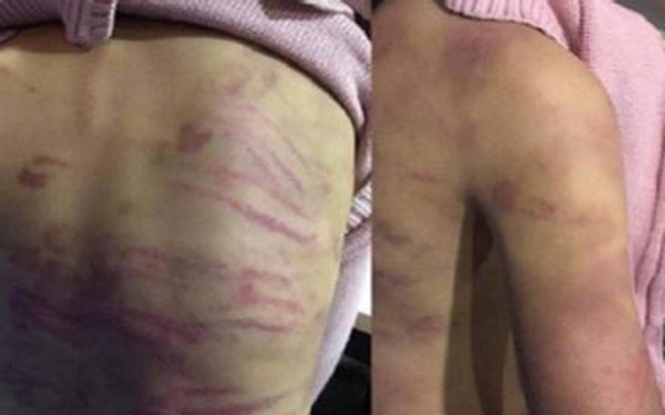 Vụ bé gái 9 tuổi nghi bị "chị dâu" bạo hành bầm tím khắp cơ thể ở TP.HCM: Hàng xóm nói gì?