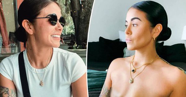 Stephanie Germino, hiện 29 tuổi, đã trải qua ca phẫu thuật sau khi cô có kết quả xét nghiệm dương tính với đột biến gen BRCA1, đây là một chỉ số cho thấy nguy cơ ung thư vú tăng lên (Ảnh: Stephanie Germino/Carters News) Stephanie Germino, hiện 29 tuổi, đã trải qua ca phẫu thuật sau khi cô có kết quả xét nghiệm dương tính với đột biến gen BRCA1, đây là một chỉ số cho thấy nguy cơ ung thư vú tăng lên (Ảnh: Stephanie Germino/Carters News)