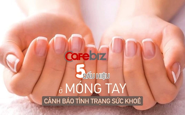 Không chỉ làm đẹp, việc chăm sóc móng tay còn cực kỳ quan trọng để giữ cho móng luôn khỏe mạnh. Bạn muốn có sức khoẻ móng tay tốt? Chỉ cần xem ngay hình ảnh về cách chăm sóc móng tay hiệu quả và sử dụng các sản phẩm chăm sóc móng tay chất lượng cao để đạt được kết quả tuyệt vời.