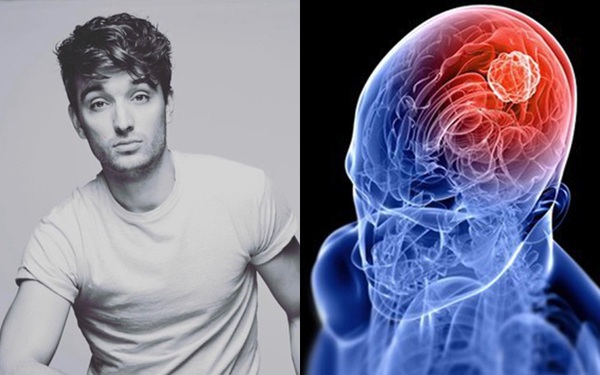 Tom Parker- The Wanted member passed away after only 2 years of fighting brain cancer