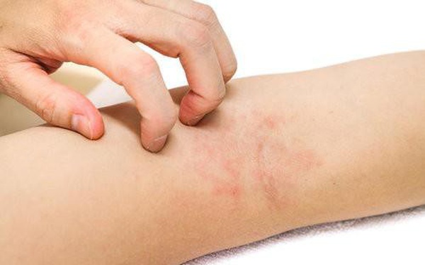 Crazy itchy skin, maybe you have one of the following ‘serious diseases’