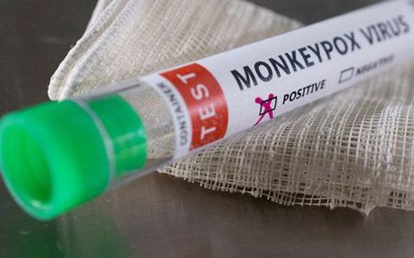 UK confirms community spread of monkeypox