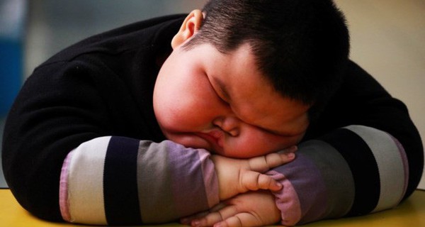 Châu Á chiếm 50% tỷ lệ trẻ em béo phì trên toàn cầu