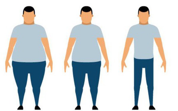 Hiểu về phẫu thuật giảm béo: phương pháp cứu cánh cho những người thừa cân quá độ