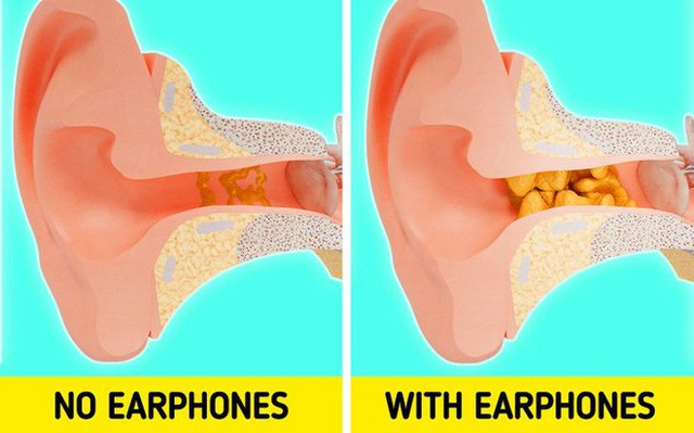 Cảnh báo: Nếu tiếp tục đeo tai nghe lâu, đây sẽ là điều xảy ra với cơ thể bạn - Ảnh 1.