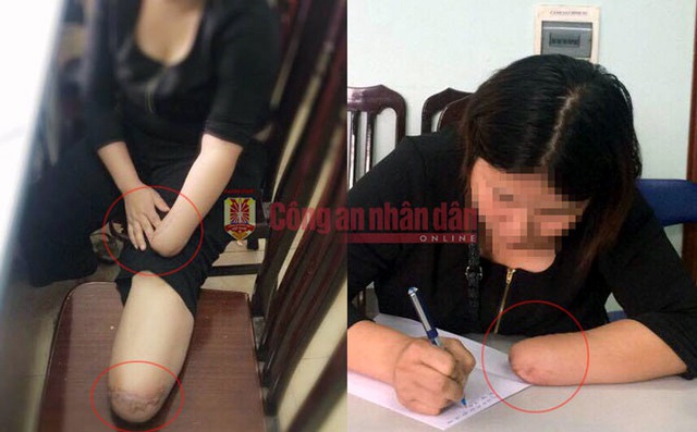 Từ vụ Bí thư xã giết cháu vợ, giả chết lấy tiền bảo hiểm, nhìn lại những vụ trục lợi bảo hiểm chấn động Việt Nam - Ảnh 2. Từ vụ Bí thư xã giết cháu vợ, giả chết lấy tiền bảo hiểm, nhìn lại những vụ trục lợi bảo hiểm chấn động Việt Nam - Ảnh 2.