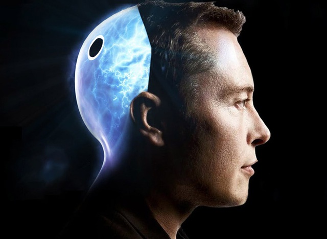 Neuralink và tham vọng cộng sinh với trí tuệ nhân tạo của Elon Musk - Ảnh 11.