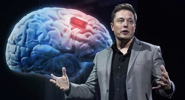 Neuralink và tham vọng cộng sinh với trí tuệ nhân tạo của Elon Musk - Ảnh 3.