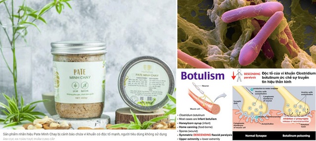  Vi khuẩn Clostridium botulinum có trong sản phẩm Pate Minh Chay nguy hiểm thế nào? - Ảnh 2.