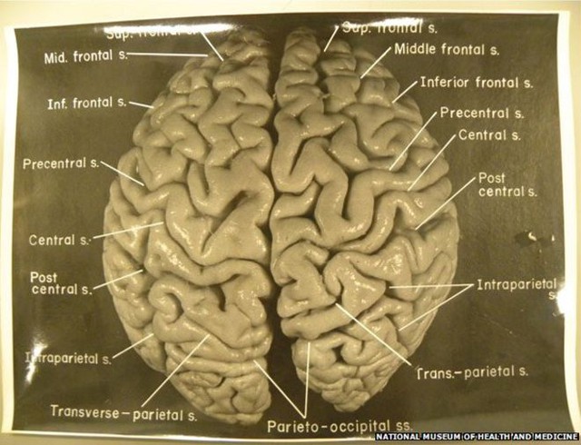 Cái chết của Albert Einstein và hành trình kỳ lạ của bộ não thiên tài - Ảnh 7. Cái chết của Albert Einstein và hành trình kỳ lạ của bộ não thiên tài - Ảnh 7.