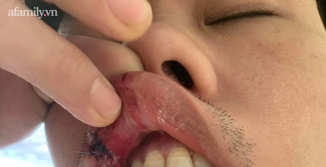 Hà Nội: Tranh cãi chuyện vé xe, nhóm bảo vệ đánh cư dân nhập viện - Ảnh 2.