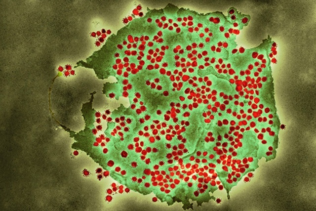 Giải mã từng chữ số trong tên biến thể virus SARS-CoV-2: B.1.1.7, B.1.351 nghĩa là gì? - Ảnh 2.